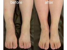 ヘレン(Helen)/リンパマッサージ＊足裏