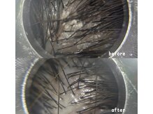 リリールア(Rere-Rua)/頭皮洗浄×頭皮ケア！