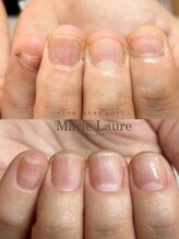 マリーロール 梅田店(Marie Laure)/深爪矯正/自爪育成/自爪風