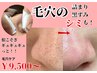 当店自慢！の毛穴ケア★シミ毛穴ケア　黒ずみ毛穴　詰まり毛穴　9,500円