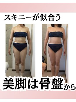 エミフル(EMIFULL)/お客様の変化　5回施術