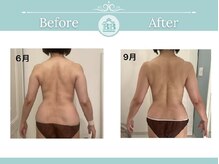 美人バスト 掛川店/痩身症例