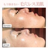 エステサロン マコ(MaCo)