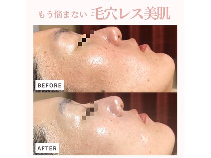 エステサロン マコ(MaCo)の写真