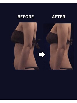 エクレボーテ(ECOULERBEAUTE)/リンパマッサージ施術例