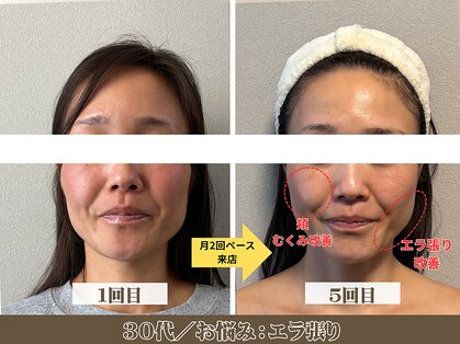 コガオラボ 甲府店(KOGAO LABO)の写真