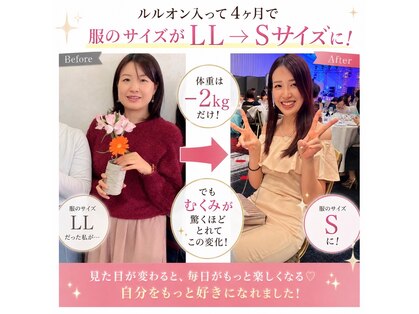ヨサパーク リープ(YOSA PARK Leap)の写真