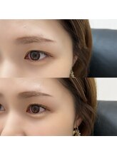 ミー(Me)/【L3トリートメントパーマ】