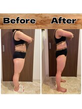 あきくに整骨院 美容整体院/N様ビフォーアフター