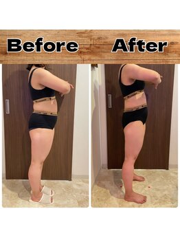 あきくに整骨院 美容整体院/N様ビフォーアフター