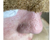 天使の毛穴 岐阜羽島店の雰囲気（毛穴洗浄の機械を使わず、オールハンド!!奥底の毛穴汚れにも対応）