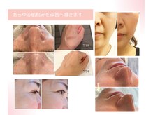 ディディモア サロン(DDmore Salon)の雰囲気（年齢肌専門店のこだわりのコスメ＆３D小顔手技で肌悩みを改善）