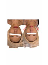 アールユー ギンザ(Ryou ginza)/肌管理フェイシャル　