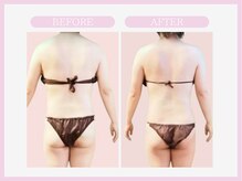 スリムライン 山形店(The Slim Line)/before→after