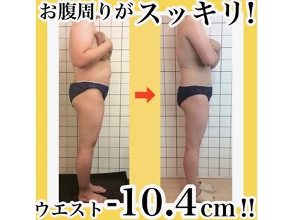 本気で痩せたい女性のための痩身専門サロン Restore meの写真