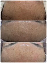 エルナ(Eluna)/美肌覚醒プログラム　セルマン