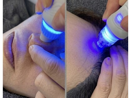 ［よもぎ蒸し/毛穴/ヘッドスパ/痩身］salon LEO 藤崎【4月1日 NEW OPEN（予定）】の写真