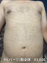 カナウ(KANAU)/【MLパーツ/脱毛】胸全体