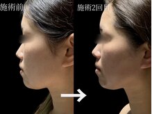 ルイス(LOUIS)の雰囲気（【徹底たるみケア】最新LDMリフト×オールハンド手技で小顔へ♪）