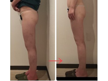 リズ(Liz)/痩身エステ美脚