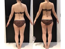 リボディ 表参道(An re Body)/before→after