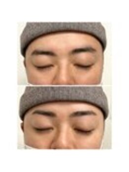 アイビー 神保町店(i.b)/眉【before⇒after】８７