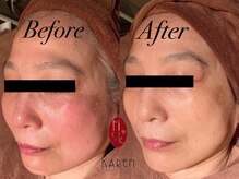 カレン 鹿児島中央駅店/イオン導入