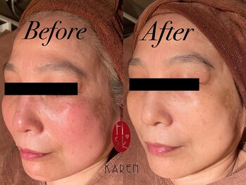 カレン 鹿児島中央駅店/イオン導入