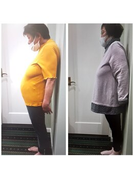 こじ 金沢院/圧倒的効果☆