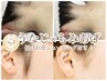 《女性◆IPL脱毛》うなじ×もみあげ脱毛＋似合せシェービング￥4980