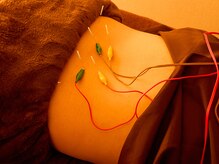 肩凝り/腰痛/眼精疲労/慢性疲労/不眠/むくみ/更年期症状/美容鍼