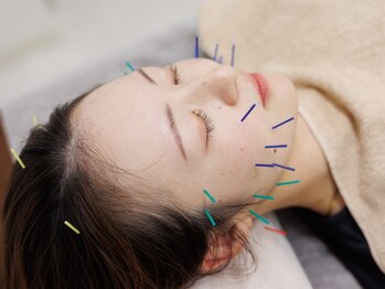 プレメ 人形町院(The Preme)/美容鍼