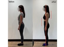 ワクワクボディ 横浜店(WAKUWAKU BODY)/30代｜反り腰が腰痛の原因に