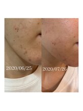 リュウ(le.lieu)/化粧品のみで、、、