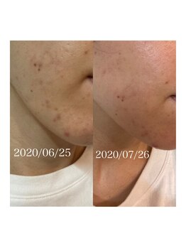 リュウ(le.lieu)/化粧品のみで、、、