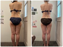 鈴木整体院 仙台泉院/小顔造顔/骨盤矯正/痩身整体