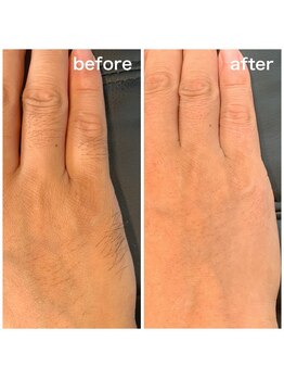 シエスタ(siesta)/ハンドメニュー(指&手の甲)