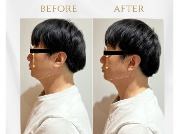 トゥジュール(Toujours)/骨格矯正美顔コース(さつま式)