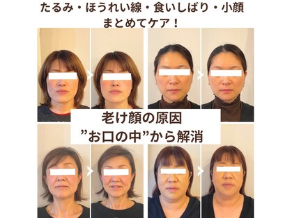 ルフレ(Reflet)の写真