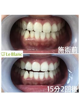 ルブラン 奈良店(Le Blanc)/印象アップのお手伝い♪