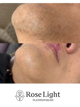 トゥインクル(Twinkle)/顎にツヤが!?