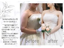 アモリール(Amolir)/ブライダル痩身3ヶ月