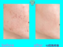 リュクス(LUXE)/ビフォーアフター