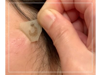 セラ(SERA)の写真