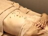【極上美容鍼灸】美容鍼＋身体鍼灸コース100分￥12,000