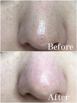 ティーツリー 名古屋 桜山(Tea Tree)/黒く見える正体は。。。