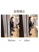 心斎橋長堀フェムテック整骨院/17姿勢矯正　骨格矯正と骨盤矯正
