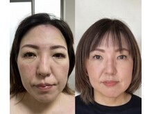 ランスソア(L'ins soi)/