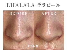 ティアム バイ テトテ 神戸三宮(TIAM by tetote)/ LHALALA ララピール