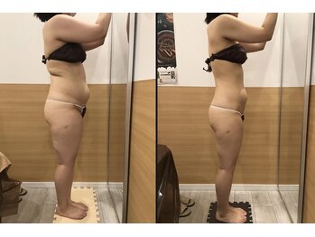 リッツ 柏店(Ritz)/【Before/After】痩身